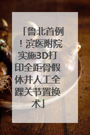 鲁北首例！滨医附院实施3D打印全距骨假体并人工全踝关节置换术
